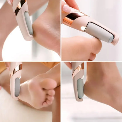 Rechargeable Electric Foot Callus Remover – Portable Pedicure Tool for Smooth & Soft Feet
